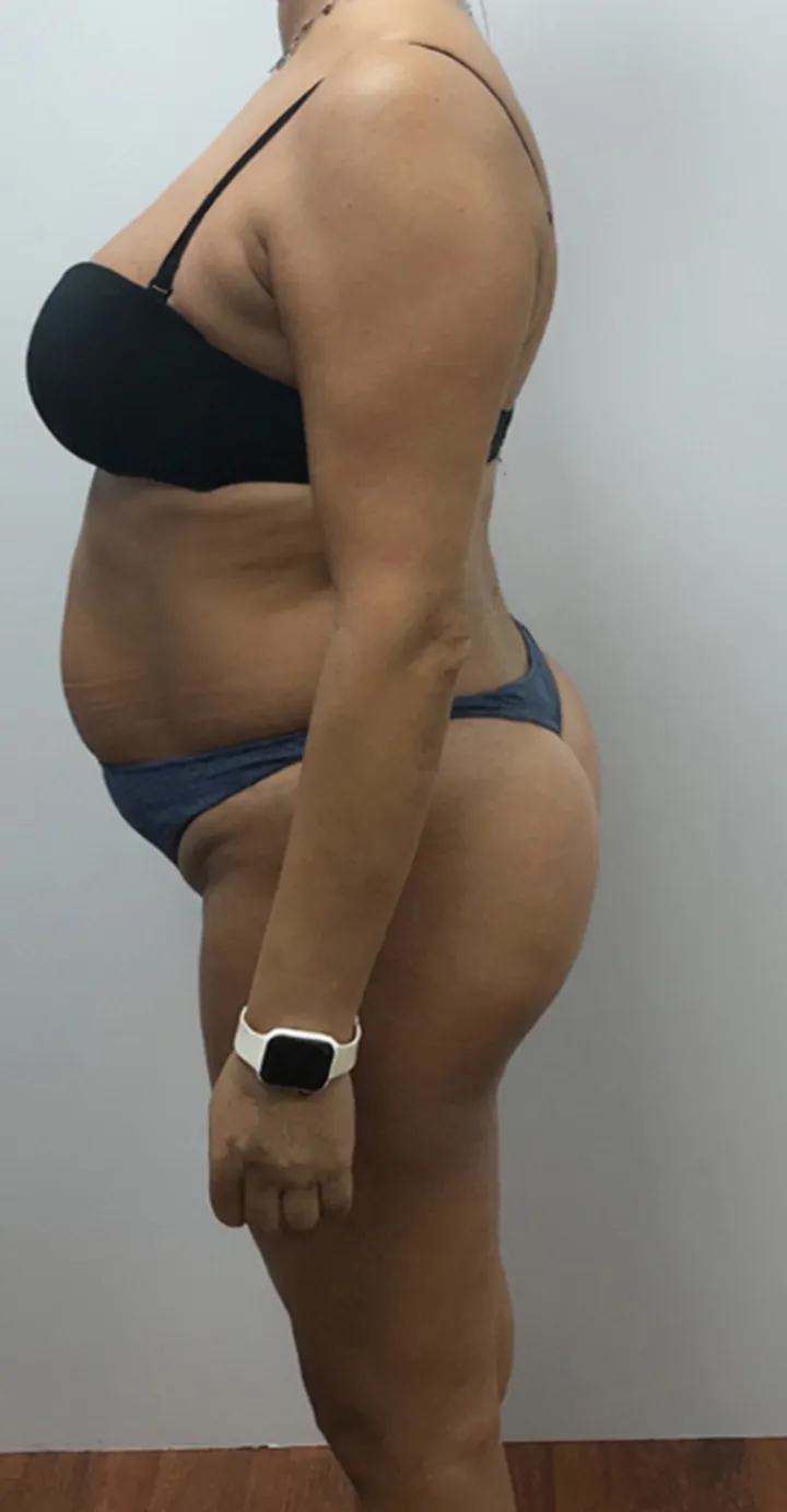 Amaia al empezar